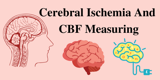 Cerebral Ischemia