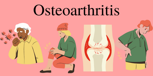 Osteoarthritis Health Impact