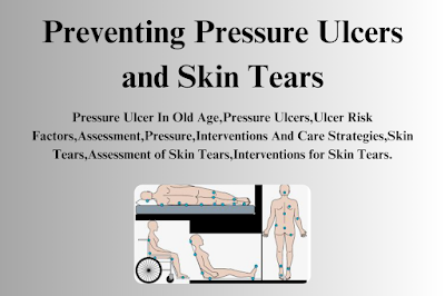 Pressure Ulcers and Skin Tears